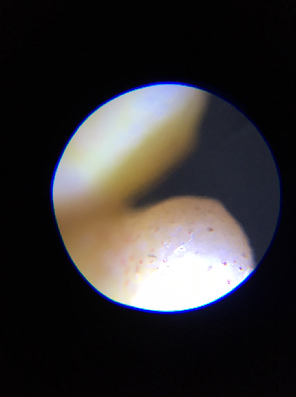 JUST FOR FUN: 32 iPhone clip on microscope magnifier Pictures